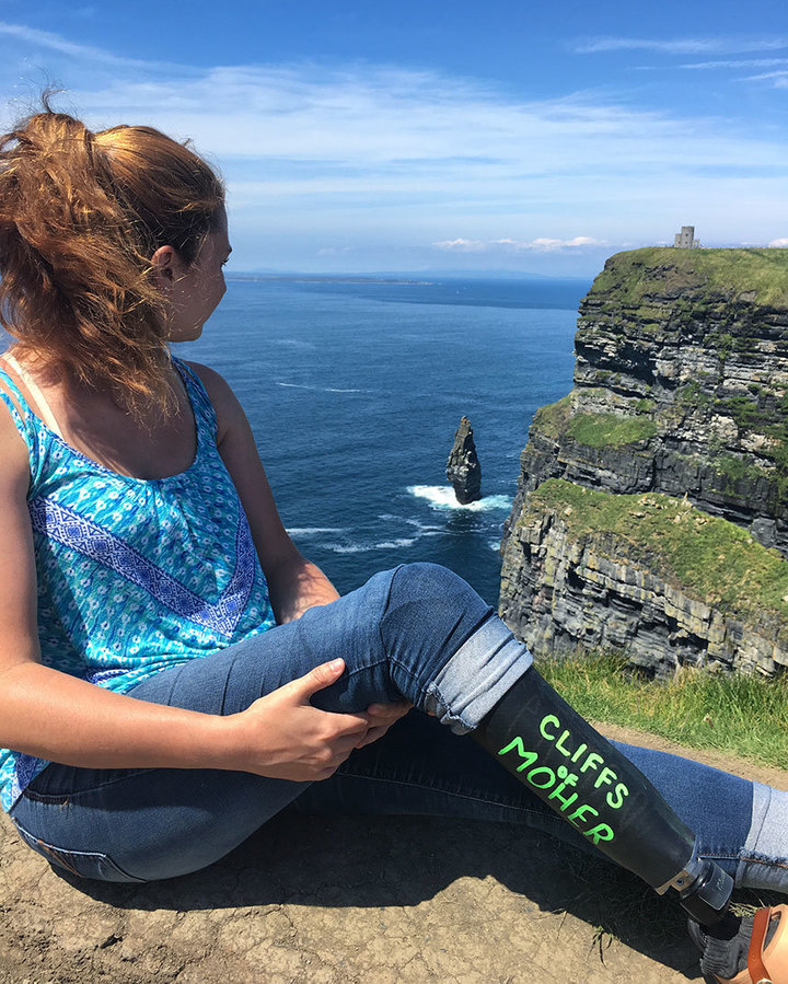 woman documents travels with chalkboard leg