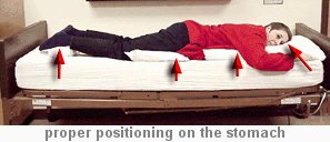 person laying on stomach on bed with pillows under head, chest, and feet with arrows pointing to pillows